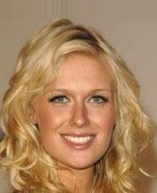 5-Star Rated Review for BioDynamix Joint Genesis - Real user transformation 2026